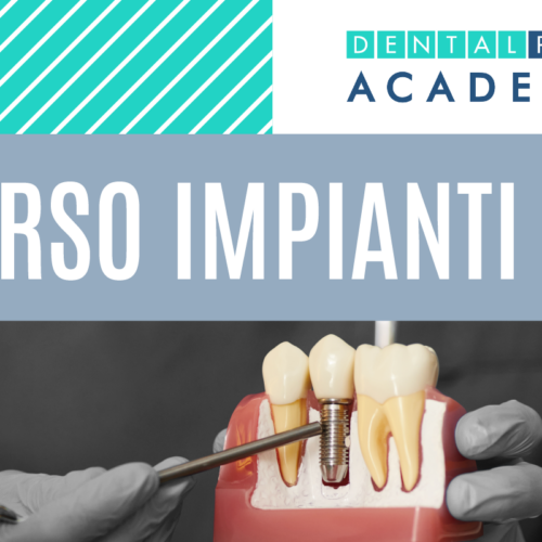 Implant Start