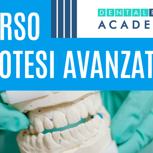 Restauri adesivi diretti anteriori e posteriori