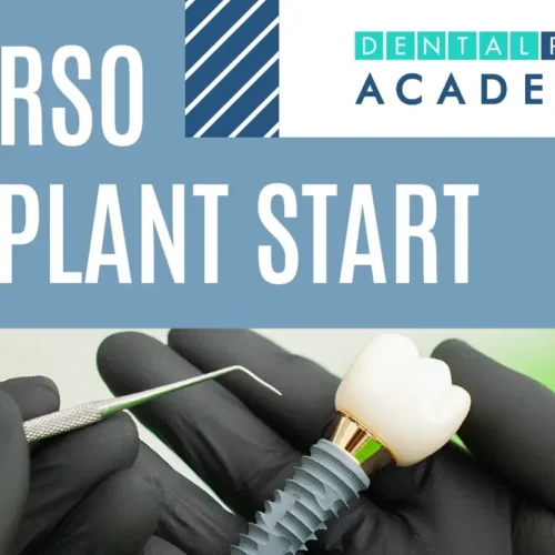 Implant Start